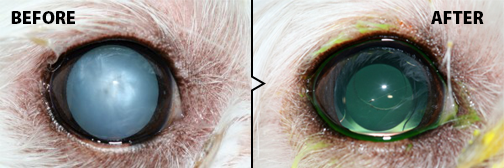 Cataract Surgery - before and after